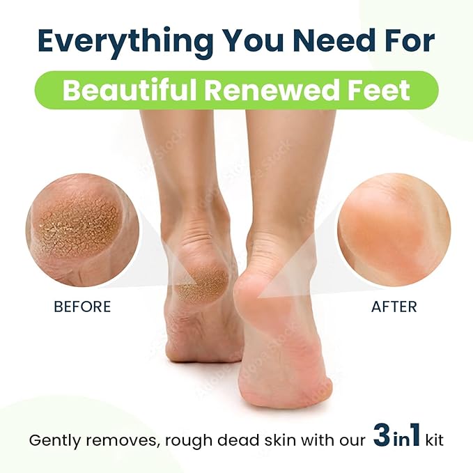 Muscle Relief Foot Soak with Epsom Salts - All Natural Salts for Post Workout - Easy Way to Remove Hard Calluses & Dead Skin Build-Up - Professional at Home Foot Care for Men & Women - Made in The USA