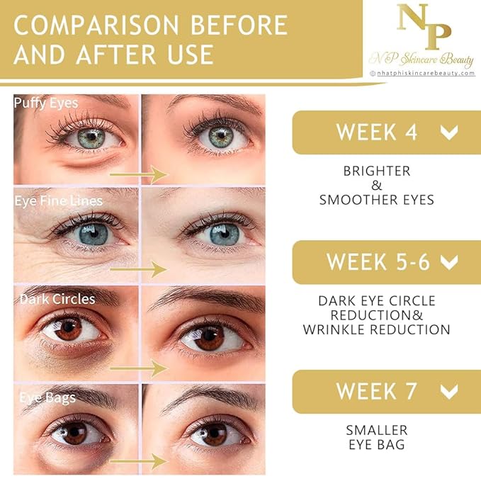 Anti-Wrinkles Eye Cream - Fast Absorbing, Natural Ingredients for Dark Circles, Puffy Eyes, and Wrinkle Reduction, 30 grams