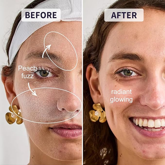 Face Razors for Women, Reusable Handle with 19 Microblades, Dermaplane Razor for Women Face, Eyebrow & Facial Razors, Peach Fuzz Remover, Gentle Exfoliating, for Sensitive Skin (Solar Veil)