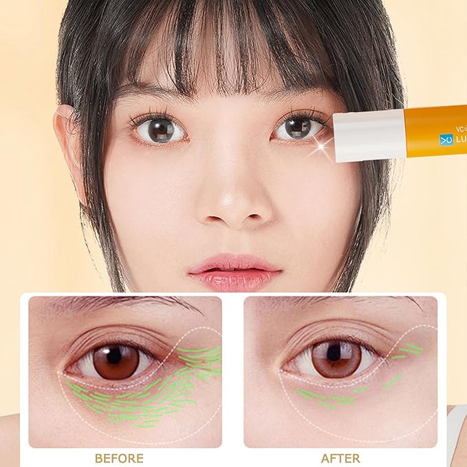 Dinkiss Lutein Eye Essence Oil - Lutein Eye Essence Oil, Lutein Eyes Vc Cream to Improve Eyes Bags Dark Circles (2pcs, 8ml/pcs)