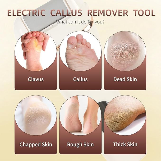 Electric Callus Remover for Feet, 17-in-1 Professional Pedicure Kit, Foot Scrubber Electric Foot File for Hard Cracked Dry Dead Skin, 3 Rollers, 2 Speed, Battery Display