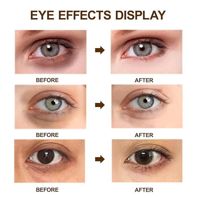 Caffeine Eye Cream for Dark Circles,Under Eye Cream for Puffiness and Bags,Eye Cream Anti Aging for Men Women Reduce Wrinkles Fine Lines, Suitable for All Skin Types 0.33 fl.oz