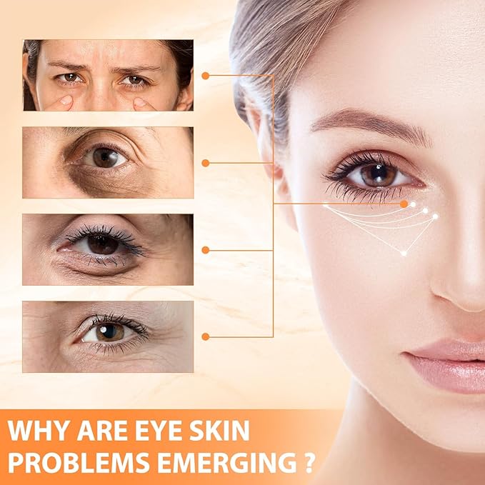 Revive + Glow Vitamin C Eye Balm,Hydrating Eye Cream,Improve Dark Circles,Refreshing and Non-Sticky (2 Pcs)