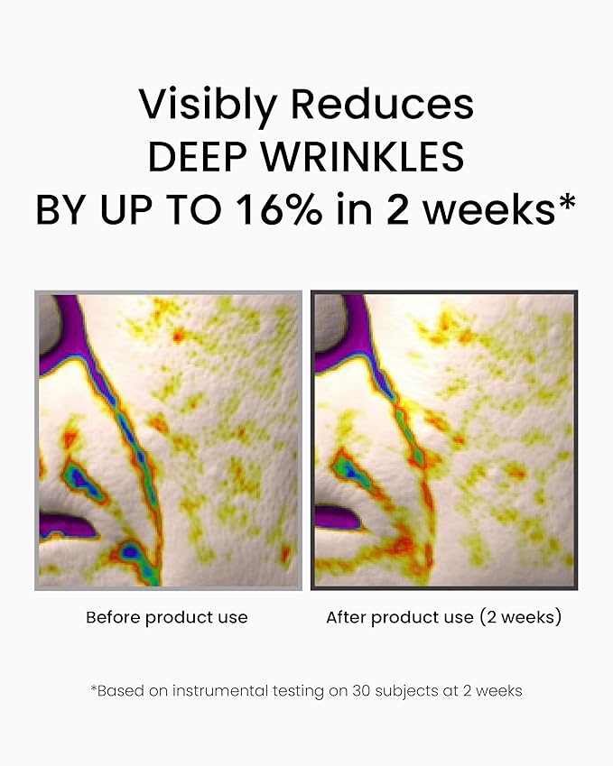 Advanced Korean Cream (1.76oz) + Retinol Serum (1fl oz) Hydration & Firming Skincare Duo with Niacinamide, Peptide, Vitamin C, TECA – Targets Fine Lines, Pigmentation & Elasticity