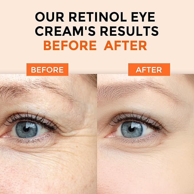 Retinol Eye Cream for Dark Circles and Puffiness, Hyaluronic Acid Serum for Face Anti Aging, Fine Lines, Dark Spots, & Dry Skin