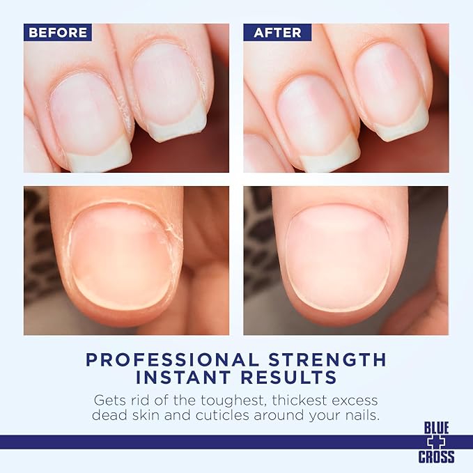 Blue Cross Cuticle Remover Cream for Dry Damaged Cuticles, Moisturizing Cuticle Softener for Nails, Professional Nail Care for Dry Manicures, Brittle Hang Nails, Made in USA, 4oz