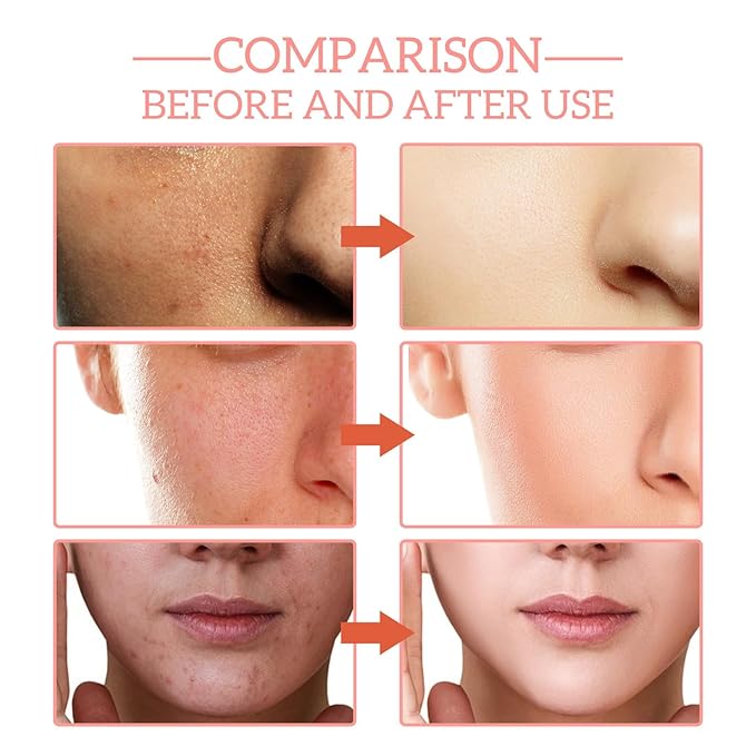 "5-in-1 Vitamin C Face Serum with Hyaluronic Acid, Collagen, Niacinamide - Anti-Aging & Moisturizing Formula for Firm, Even Skin Tone - 30ml"