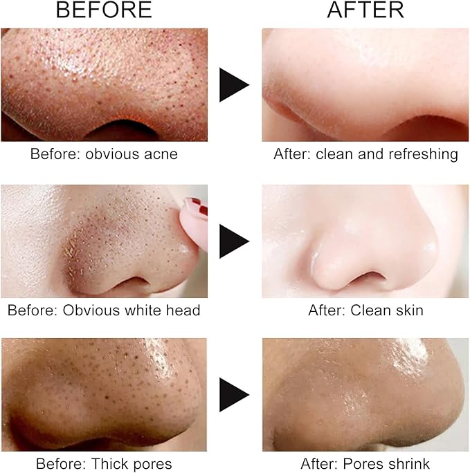Blackhead Remover Mask, Activated Charcoal Peel Off Face Mask, Deep Cleansing Mask for Face Nose, Black Head Purifying Mask with Pimple Extractor and Brush, 120g / 4.23Fl Oz