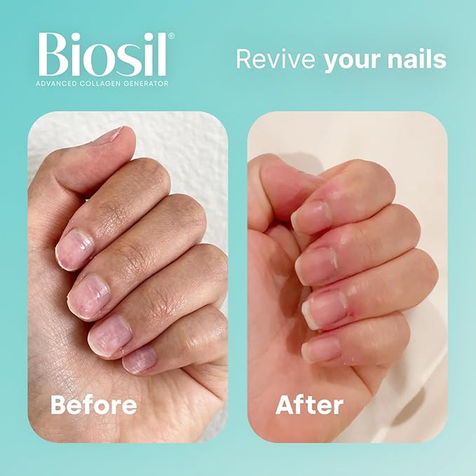 Biosil Collagen Generator - 180 Liquid Capsules, Pack of 2 - With Patented ch-OSA Complex - Generates & Protects Your Own Collagen - GMO Free - 180-Day Supply