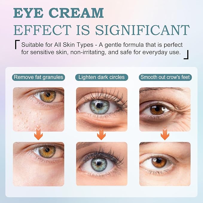 Retinol Eye Cream for Dark Circles & Wrinkles–Brighten & Smooth– Anti-Aging Under Eye Treatment with Retinol & Hyaluronic Acid–Fights Fine Lines, Puffiness & Dark Spots Fragrance– 0.68 fl.oz-BBBB