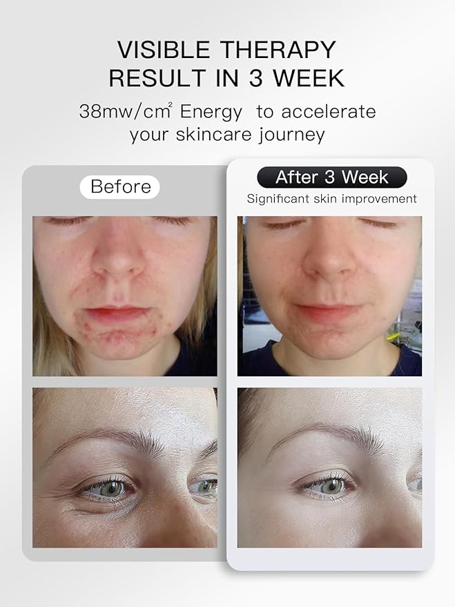 Led Face Mask Light Therapy, Near infrared Red & Blue & Yellow Light Therapy, Flexible Silicone Light Therapy Mask, Red Light Therapy for Face, Red Light Mask for at Home Face Masks Skincare