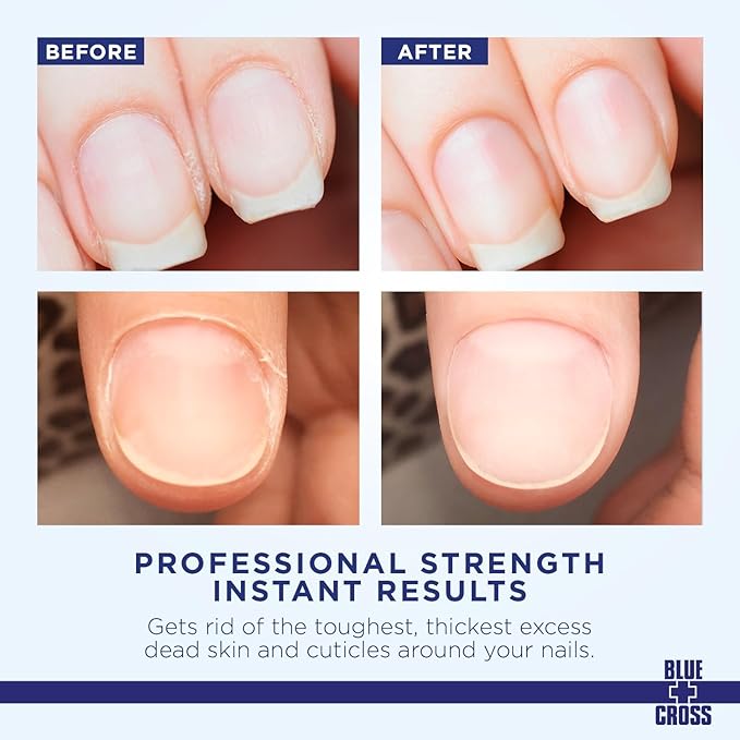 Blue Cross Cuticle Remover Liquid, Cuticle Softener for Nails, Professional Nail Care with Lanolin for Brittle Hang Nails, Hydrating, Moisturizing, Dry Cuticles, Made in USA, 6oz