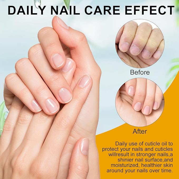 NXJ INFILILA Cuticle Oil Travel Size, Mini Cuticle Oil Repaired Dryness Nails and Cuticles, Moisturizes, and Strengthener for Nails Care Vitamin E, Milk Honey Natural Ingredients, 10ml Rollerball