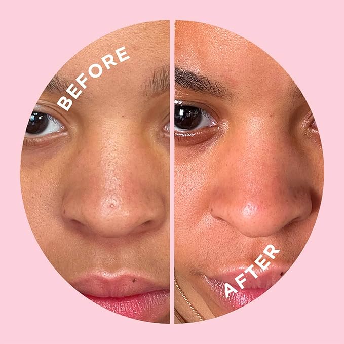 ZitSticka Hydrocolloid Surface Area Pimple Patches for Face - Clarifying Pore & Blemish for Large Zit T-Zone Coverage - Zit Sticker Absorbs Oil, Unclogs Pores, & Targets Clusters (NOSE PACK 8PC)