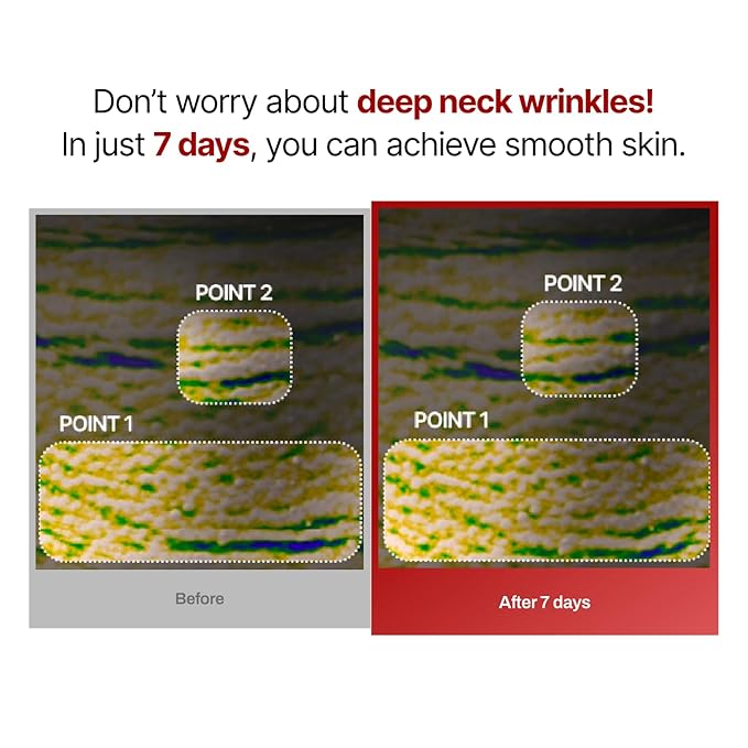 Wrinkle-fit Neck Mask - Neck Wrinkle Patches, Firming and Tightening Korean Deep Collagen Mask - Hyaluronic Acid NeckTargeted Mesh Sheet Mask for Lifting Sagging Skin - Boosting Elasticity 7EA