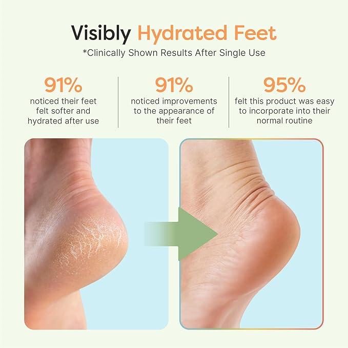 ZenToes Moisturizing Socks for Cracked Heel Treatment - Vitamin E, Olive Oil and Jojoba Oil Infused Heel Socks to Soften and Hydrate (Yellow & White Daisies, Regular)