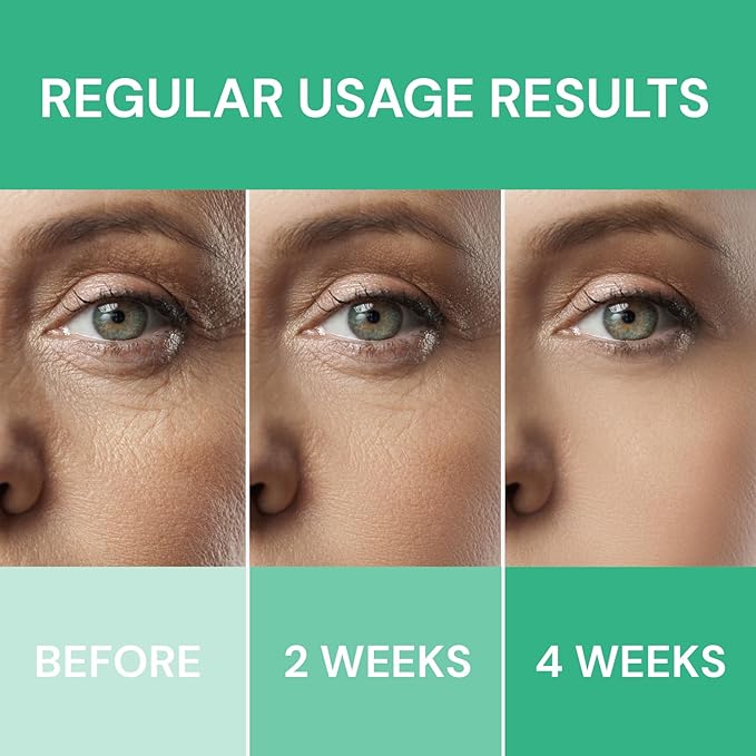 Retinol Cream for Face: Anti-Wrinkle Moisturizer for Deep Wrinkles, Dry Skin & Neck Firming for Men & Women