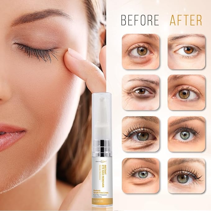 Instant Eyebag Remover Anti Aging Reduce Dark Circles, Puffiness, Under Eye Bags, Wrinkles & Fine Lines For Men & Women