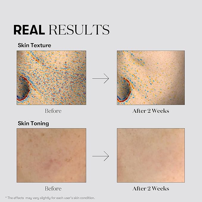 VT COSMETICS TX Toning Essence 1000 Shot, Tranexamic Acid Serum with Niacinamide, Glutathione for Radiant Glass Skin Face, Dark Spots, Acne Scar, Sensitive Skin Care, Korean Skincare, Fragrance-Free