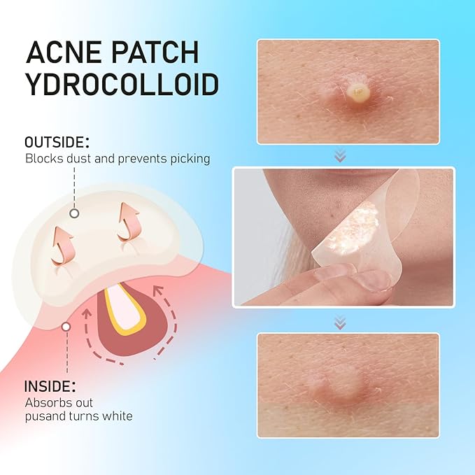 Large Pimple Patches for Face, Hydrocolloid Acne Patches, Zit Patches for Large Troubled Face, Chin, Back Blemish Patches Acne Spot Treatment Blemish Patches Pimple Stickers