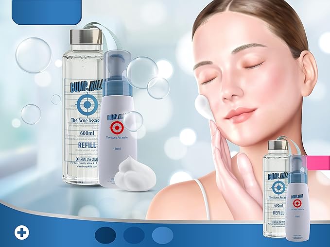 Acne Treatment For Sensitive Skin - 80% of Acne Gone in 4 Weeks. Pimple Cream Stops Face Acne and Teen Acne Without Drying or Irritating Skin. Zit Cream, Face Toner for Pimple Prone Skin.