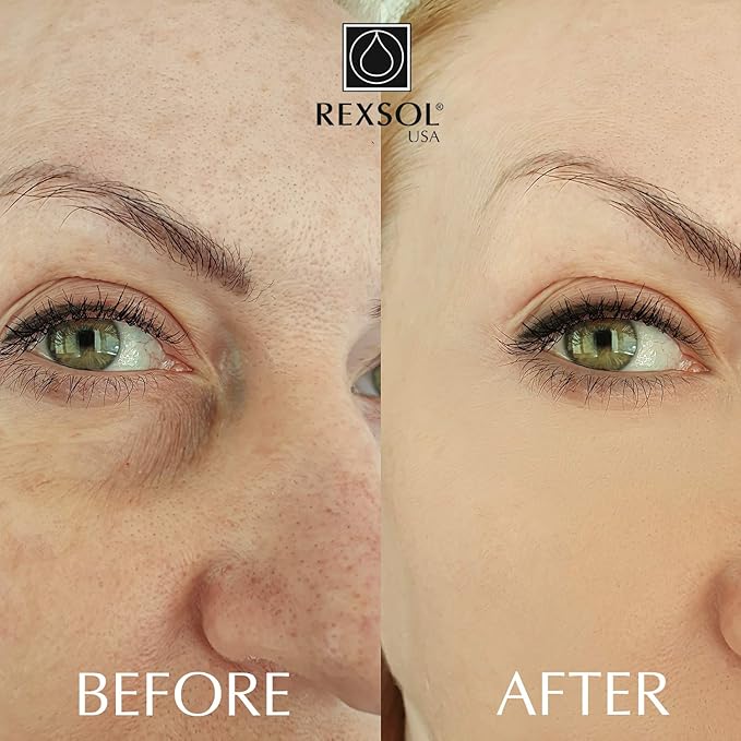 REXSOL Retinol + Vitamin C Anti-Aging Cream | Effective Night Face Care & Dark Spot Remover | Anti-Aging Neck Cream & Wrinkle Cream That Truly Works | Infused with Vitamin E, A - 2 OZ