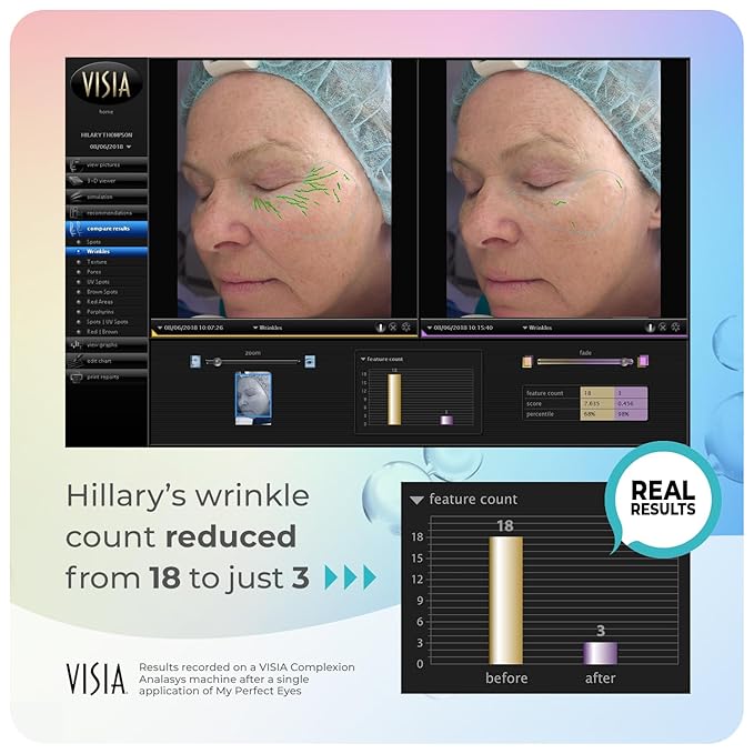 My Perfect Eyes by Penny Lane | Anti-Aging Eye Cream for Dark Circles & Puffiness | Instant Firming Treatment for Wrinkles & Fine Lines | Undereye Serum to Reduce Bags & Hollows | 20ml