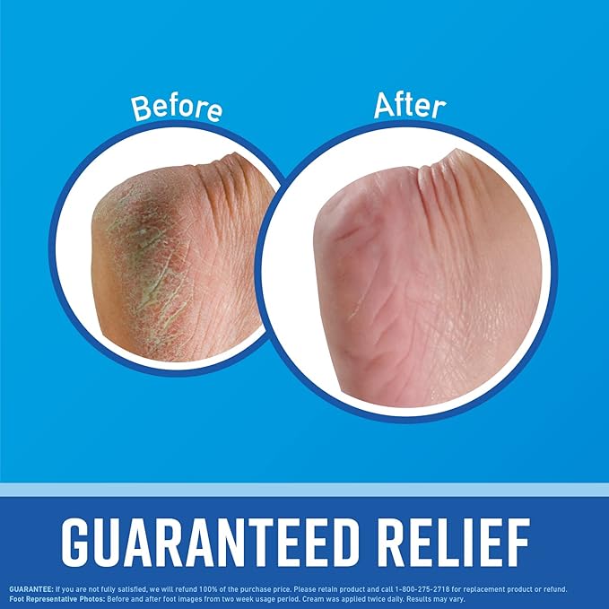 O'Keeffe's for Healthy Feet Foot Cream - 6.4 oz Jar (1 Pack) - Guaranteed Relief for Extremely Cracked, Dry Feet, Repairing Skincare, Instantly Boosts and Retains Moisture Levels
