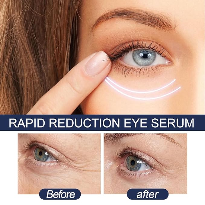 Rapid Reduction Eye Serum - Advanced Formula - Anti Aging Serum Visibly Reduces Under-Eye Bags-q2
