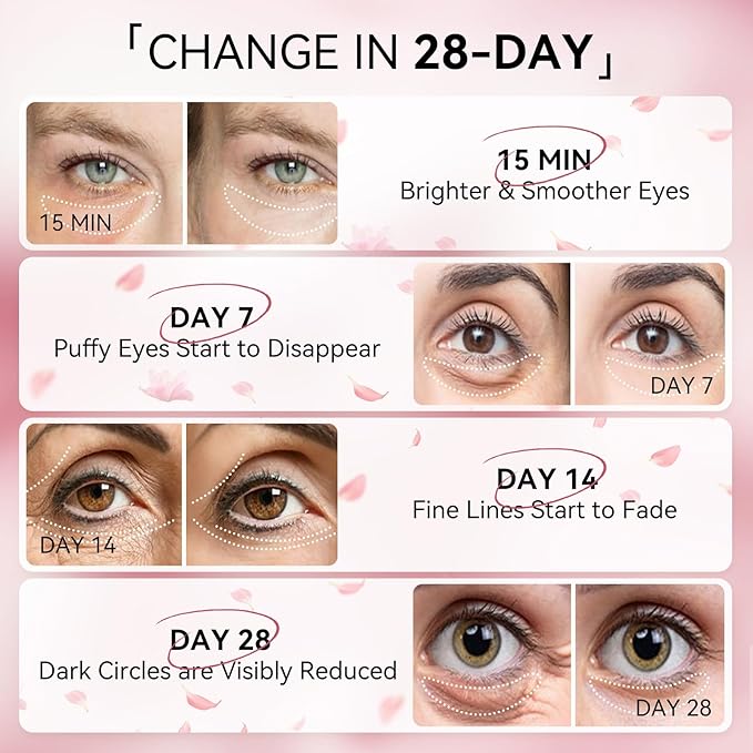 BREYLEE Rose Eye Mask - 60 Pcs Under Eye Treatment for Puffy Eyes, Wrinkles, Dark Circles and Fine Lines (Rose)