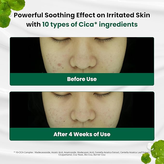 Dr.G Red Blemish Clear Soothing Korean Moisturizer Face Cream, 70ml - Cica Cream, Korean Skin Care Moisturizer, Korean Face Moisturizer, Facial Moisturizer, Korean Skincare, K Beauty Skincare Coreano