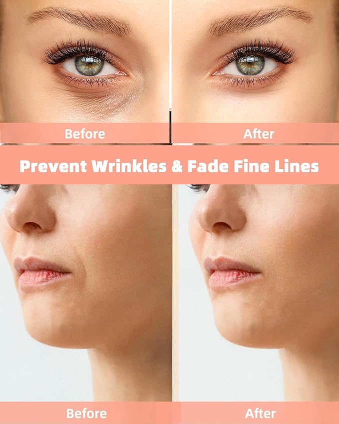 Reusable Eye and Smile Line Patches - 2 Pairs Silicone Under Eye Patches and Nasolabial Folds Patches, Reusable Eye Mask, Silicone Wrinkle Patches for Eye Lines & Smile Lines Treatment, No Adhesive