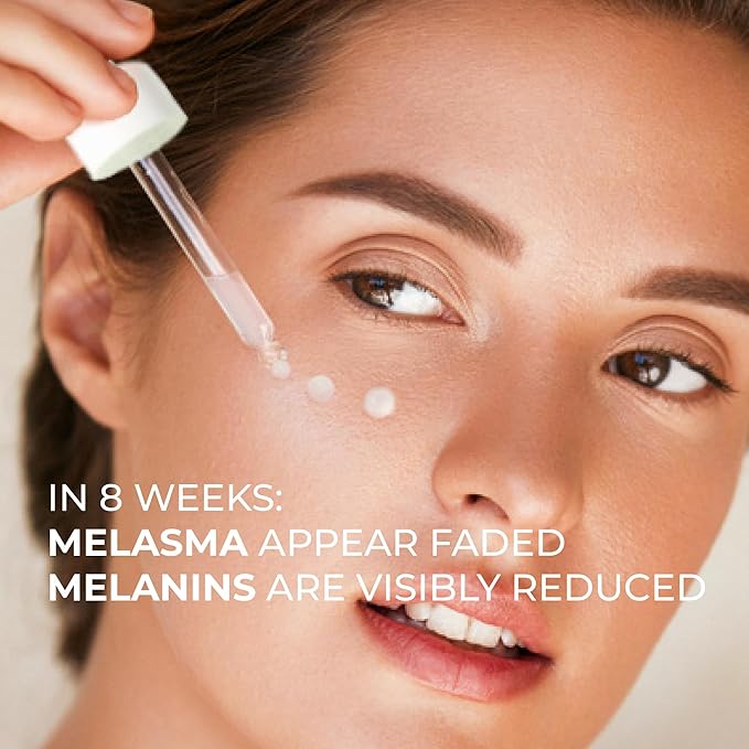 Abera Melasma Serum with Niacinamide and Hyaluronic Acid, Dark Spot Corrector Serum, Melasma Treatment for Face, Suitable for All Skin Types, 0.68 fl. Oz, Set of 3