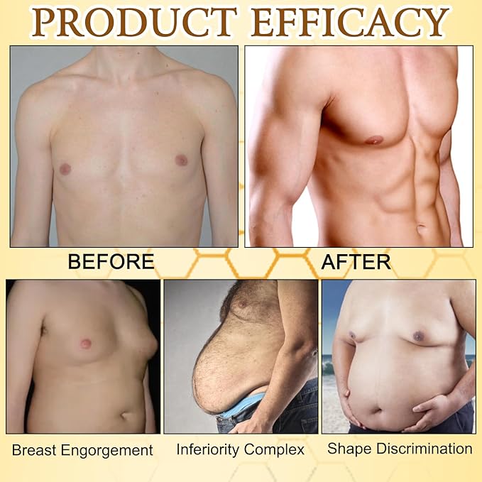 Thermofirm Bee Venom Gynecomastia Oil, The Chest Muscles Bee Venom Oil, Advanced Bee Venom for Strengthen The Chest Muscles 2PCS