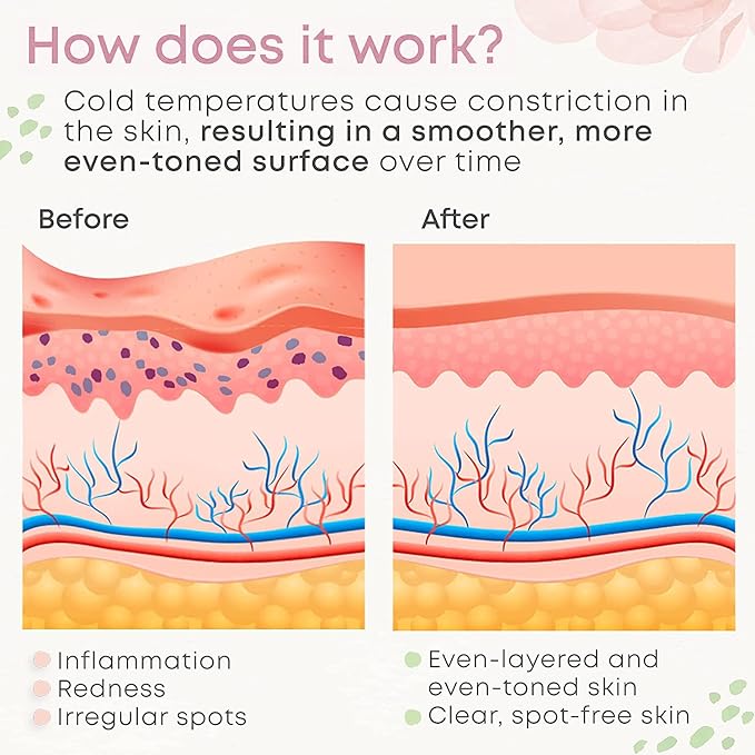 Ice Roller for Face & Eye，Facial Skin Care Tools Face Roller Massager - Reduce Puffiness Migraine Pain Relief, Idea Gifts for Women Men (Pink)