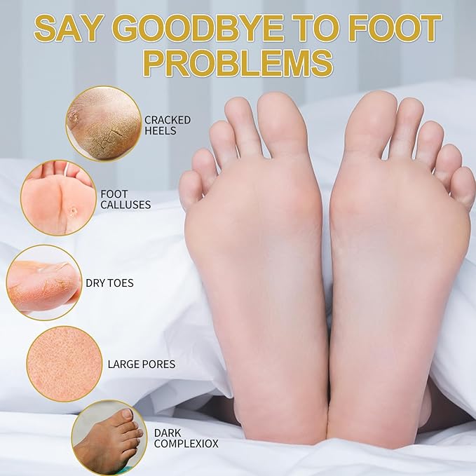 Pedicure Kit Foot Soak Set: Bubble Salt, Sugar Scrub, Massage Mask, Massage Lotion in a Box, 4 Step Foot Spa Kit for Dry Feet, Calluses and Tired Feet(1 Set Honey Flower)