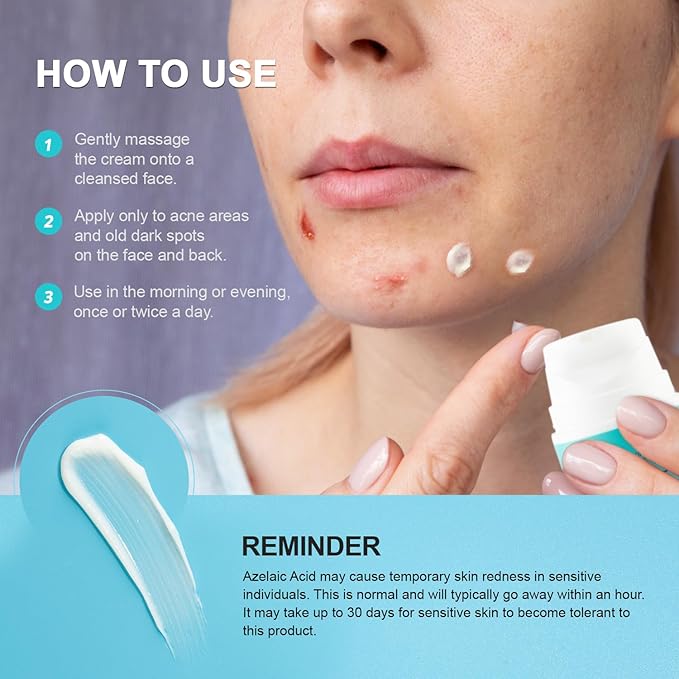 Acne Pimple Spot Treatment Cream: Cystic Hormonal Blackheads Blemish Remover for Face, Back and Body - with 10% Azelaic Acid - Teens 13-19 & Young Adult 20-30, 1.8 oz