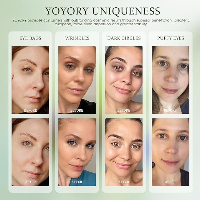 Under Eye Patches Masks - for Dark Circles, Eye bags puffiness Smoothing Skin Care Treatment, and Fade Wrinkles, Fine Lines with Collagen and Hyaluronic Acid for Women and Men, (60 Pcs) Green