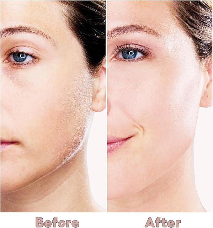 Facial Hair Removal for Women, Painless Face Trimmer for Upper Lips, Peach Fuzz and Chin with USB Rechargeable