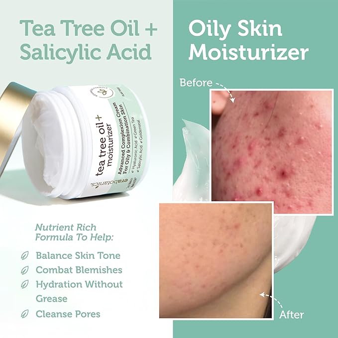 Era Organics Tea Tree Cream Face Moisturizer for Oily Skin - Advanced 7X Balancing Oily Skin Moisturizer - Non-Greasy Moisturizer - Tea Tree Oil for Skin