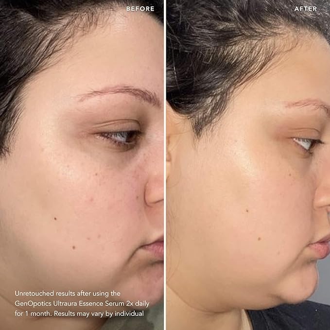 SK-II GenOptics Essence Brightening Serum - Radiance Boosting Face Serum to Target Sun Spots, Dullness & Uneven Texture - Improves Natural Regeneration for Youthful Skin (1.7 oz)