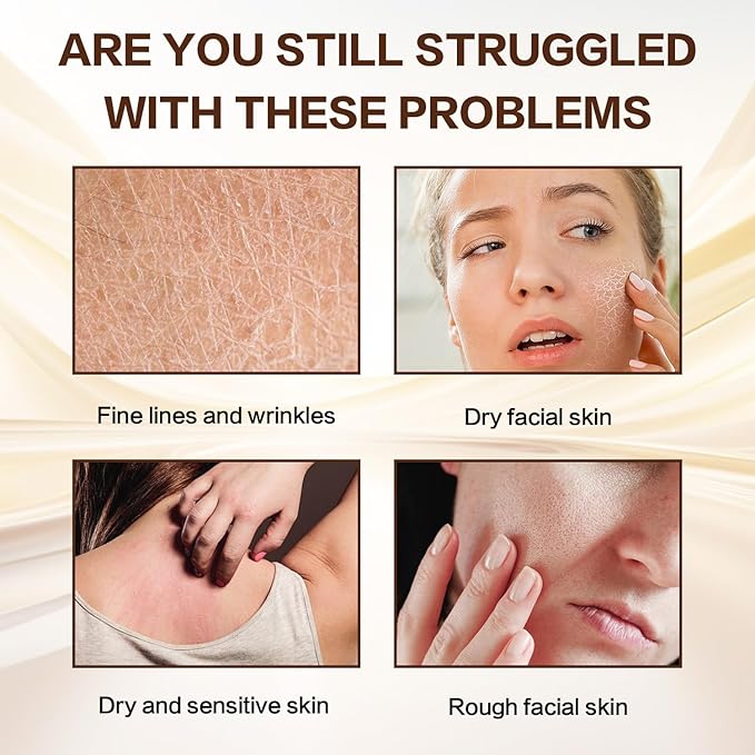 ANNA'S Beef Tallow and Honey Balm for Skin, All-Natural Moisturizer for Face and Body, Hydrating Grass-Fed Beef Tallow & Raw Wild Honey Blend (60g/2.120z)