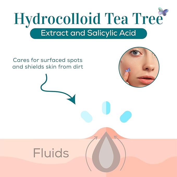 My Beauty Spot Pimple Patches Cute Acne Patches for Face (140 Patches) with Hydrocolloid, Tea Tree Extra & Salicylic Acid, Colorful Fun Designs – Pimple Patches for Face Acne Spot Treatment