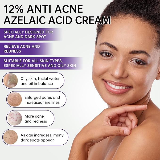 Azelaic Acid 12% Cream For Face, Azelaic Acid Acne Cream For Rosacea Treatment, Redness Relief, 0.7 OZ Azelaic Acid Gel With Salicylic Acid & Niacinamide For Dark Spot, Skin Care.