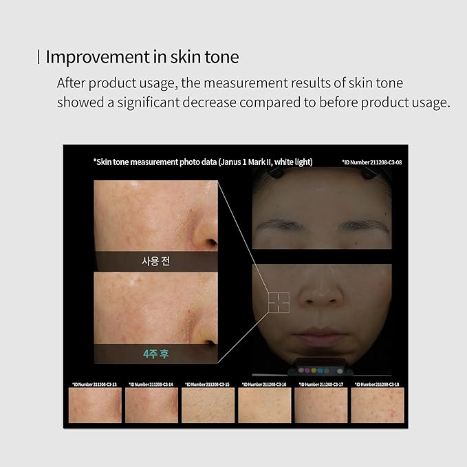 Edelweiss Lifting Serum – Anti-Aging Formula with Edelweiss Extract, Niacinamide, Peptides for Firming, Hydration & Brightening – 1.35 fl.oz