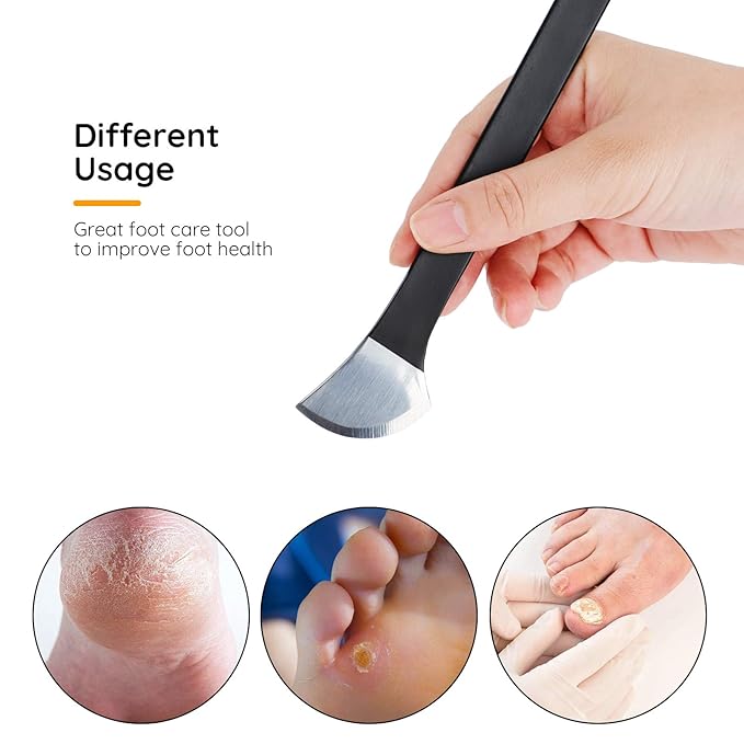 Pedicure Knife Set, Segbeauty 4 Pack Ingrown Toenail Knife, Correction Nippers Clipper Remover with Carrying Bag, High Manganese Steel Nail Care Foot Repair Cutter for Calluses Beauty Salon Home Usage