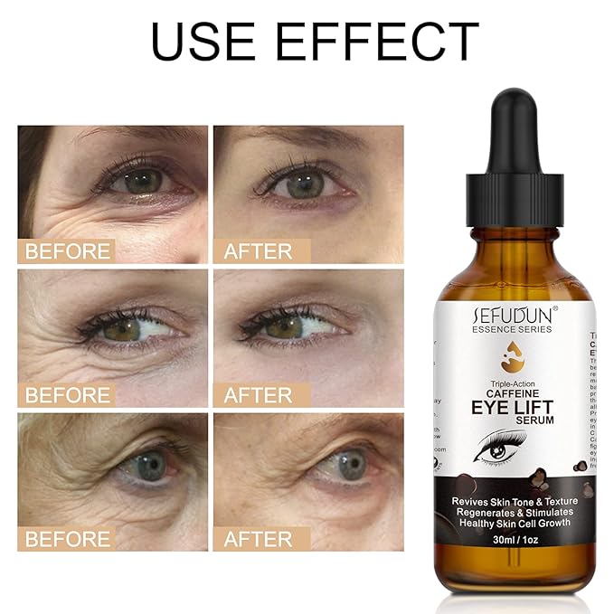 Caffeine Eye Serum + EGCG, Eye Serum for Dark Circles and Puffiness, Under Eye Serum Reduces Puffiness, Dark Circles, Under Eye Bags, Wrinkles and Fine Lines Around The Eyes, Under Eye Serum 30ml