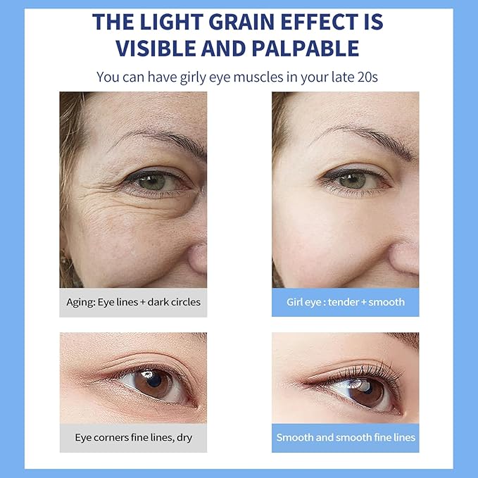 O'CHEAL Eye Cream with Vibrating Electric Massage Head- Hydrating, Brightens, Tightens, Reduces Dark Circles & Wrinkles, Bags Remover Under Eyes Cream, Relieve Eye Fatigue Design for Men & Women