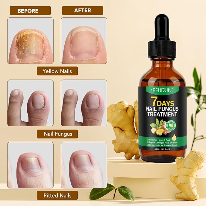 7 Day Ginger Nail Treatment 60ml, Nail Treatment, Nail Growth Serum, Ginger Nail Serum, Nail Nutrient Oil Strengthener Oil.