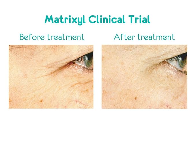 Anavita Moisturizing Anti Wrinkle Anti Aging Cream W/Peptide & Hyaluronic Acid - Day Night - Facial Fine Lines Wrinkles Elasticity Skin Tone - Face Neck Decollete Moisturizer for Women Men 1.7 fl oz